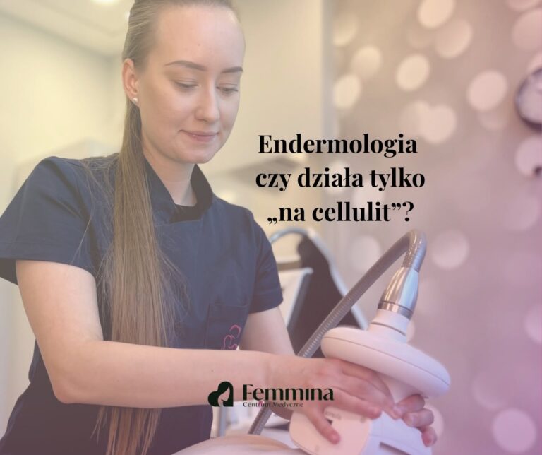 Masaż podciśnieniowy endermologia na cellulit w Femmina Centrum Medyczne Opole